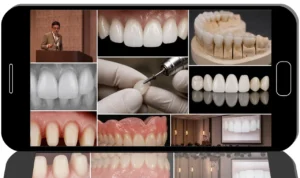 Next-Level Aesthetic Restorative Treatment. Protocols from the Legends of Japanese Dental Schools