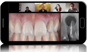 Apical surgery: for endodontists and surgeons
