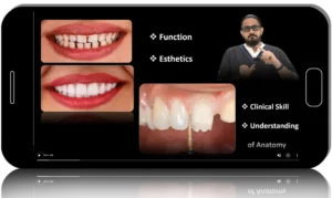Everyday Fixed Prosthodontics