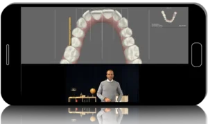 DSD Grow Your Aligner Business MasterClass