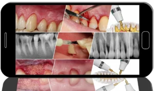 Perio-Plastic Foundations: Biology, Protocols, and B.O.P.T.