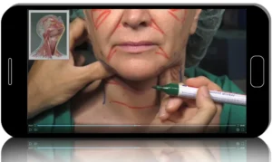 Deep Plane Face & Neck Lift With Adjunctive Rejuvenating Procedures 2025