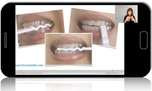 Online clear aligner training from a leading global expert