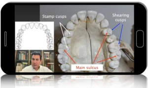 Gnathology and Occlusion: From Analysis of Occlusal Forces to Dysfunctions