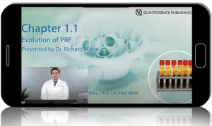 Regenerative Dentistry. PRF in Clinical Practice