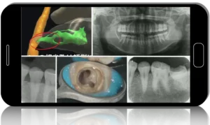 Future-Proof Endodontics: Latest Japanese Protocols