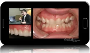 DentalXP All about Occlusion