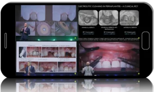 Implants in the Aesthetic Zone: From Successful Placement to Failure Management 2025