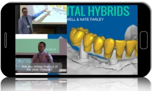 Digital Hybrids for Dentists & Technicians