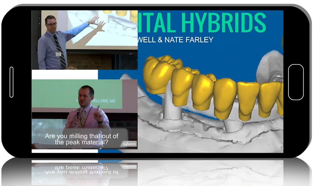 Digital Hybrids for Dentists & Technicians