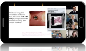 Contemporary Advances in Implantology: New Materials and Updated Protocols