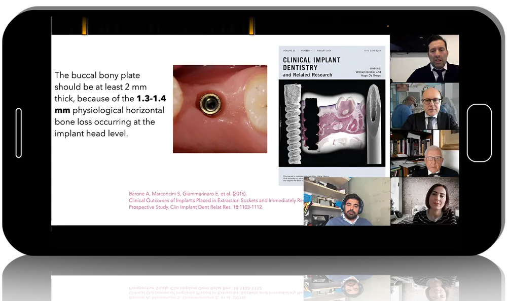 Contemporary Advances in Implantology: New Materials and Updated Protocols