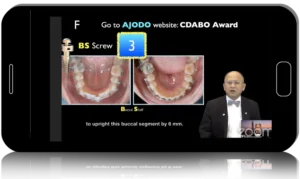 Advanced School of Orthodontics, All in One