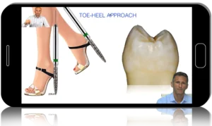 Vertical Preparation Protocols: The Complete Guide in 24 Lessons from Tomorrow Tooth