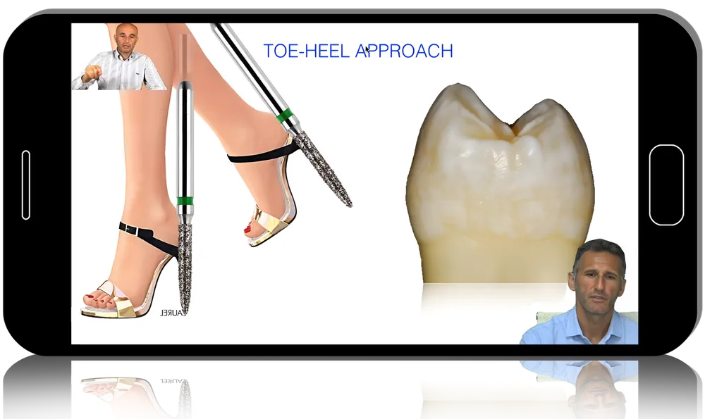 Vertical Preparation Protocols: The Complete Guide in 24 Lessons from Tomorrow Tooth
