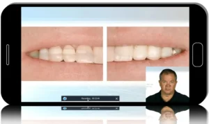 Modern Occlusion: Concepts, Diagnostics & Clinical Strategies