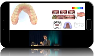 DSD iTero Intraoral Scanner MasterClass