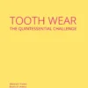 Tooth Wear: The Quintessential Challenge 2023