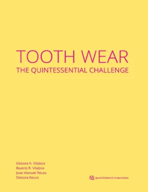 Tooth Wear: The Quintessential Challenge 2023