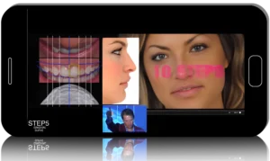 DSD Design MasterClass (OroFacial Analysis & Smile Design)
