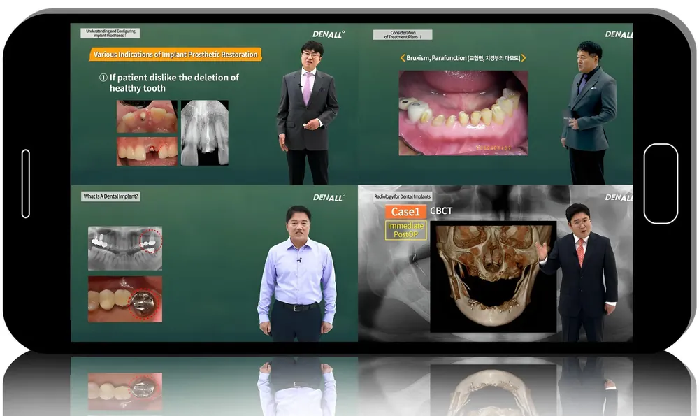 OSSTEM IMPLANT BIG COURSE: Mastering Dental Implantology