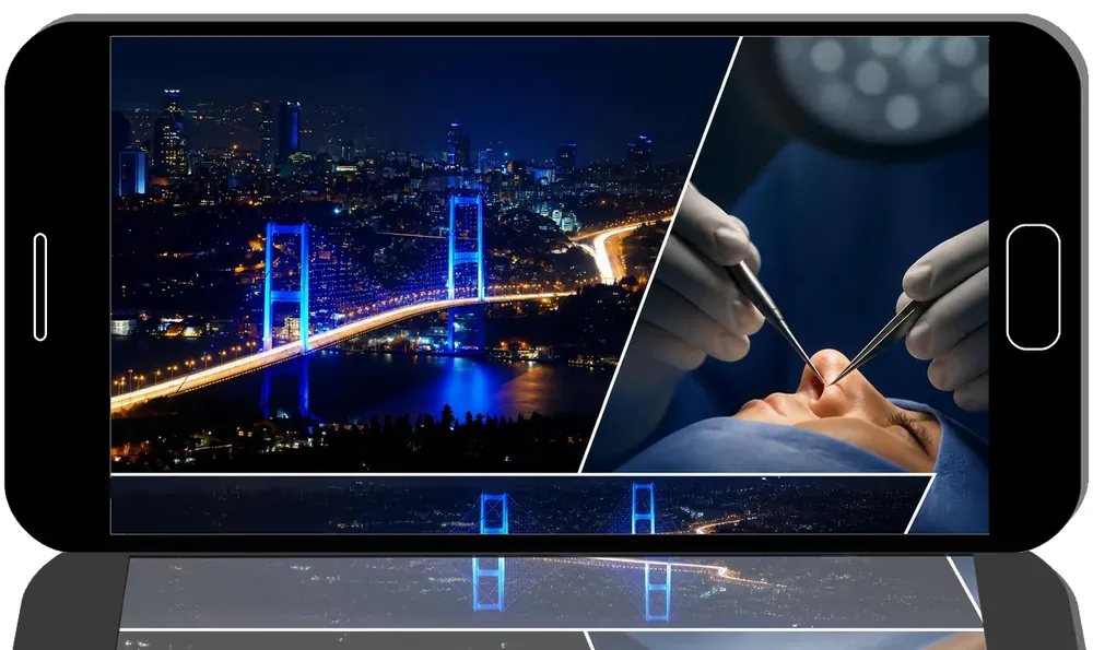RhinoVerse 2025: Advanced Techniques in Complex Rhinoplasty