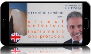 Direct Anteriors and Direct Posteriors – Why and how: instruments and protocols
