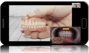 FMR (Full Mouth Rehabilitation): full course, new online version with 2024 updates