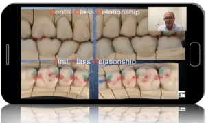 Online School on Functional Dentistry Based on Slavicek's Concept