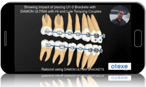 A Course on Damon Ultima