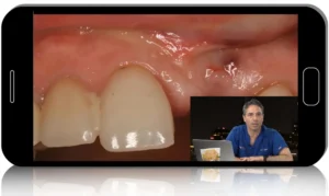 Surgical Master: Implant Blueprint Mentorship