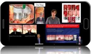 GBR. Surgical Protocols for Long-Term Regenerative Success