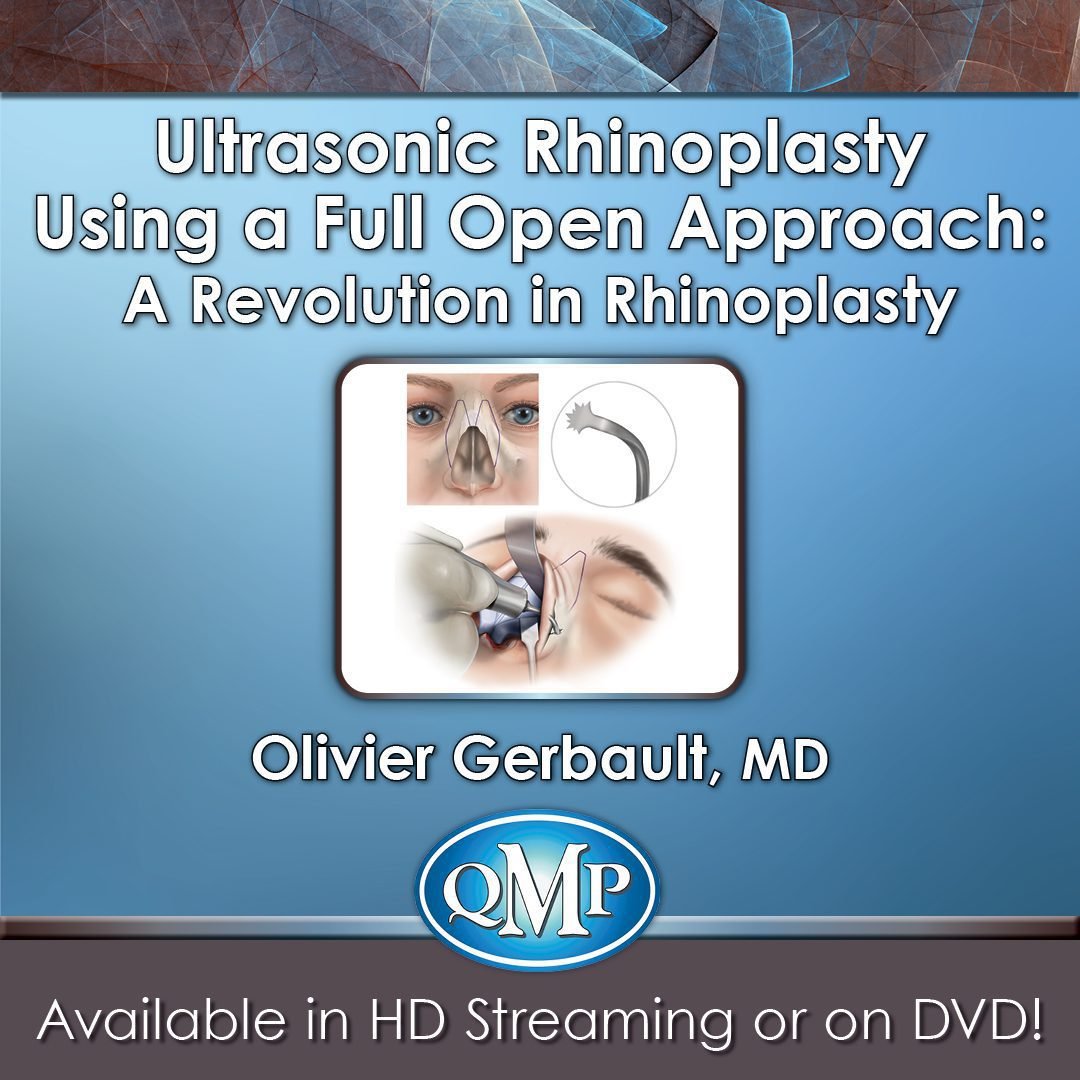 QMP Ultrasonic Rhinoplasty Using a Full Open Approach: A Revolution in Rhinoplasty