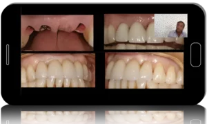 Efficiency. Accuracy. Simplification of implantological treatment. 40 years of experience and copyright techniques