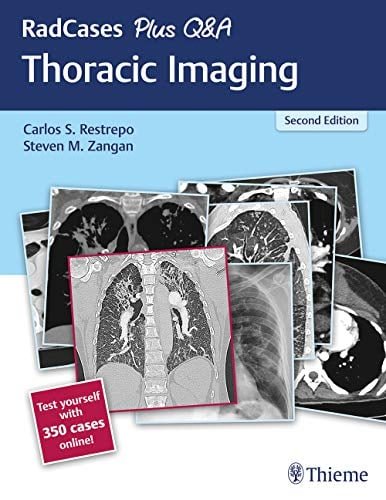 RadCases Plus Q&A Thoracic Imaging, 2nd Edition (Original PDF from Publisher)