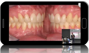 Occlusion in Everyday Practice