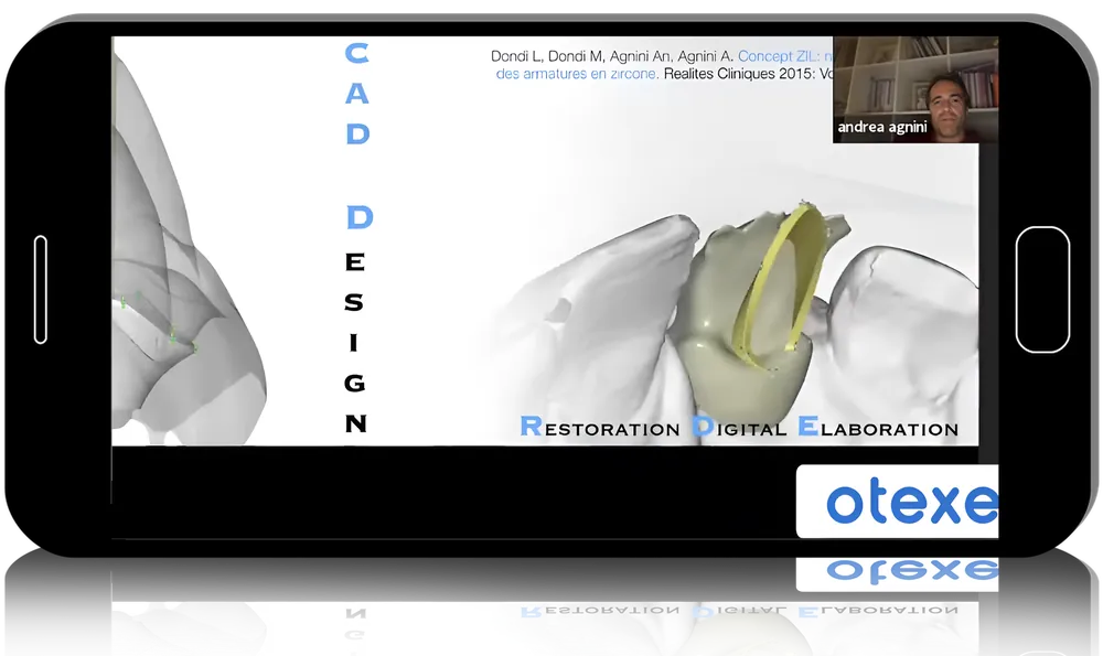 Perfection Of Modern Implantology: Aesthetics & Stability