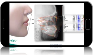 GC Orthodontics: A Practitioner’s Guide