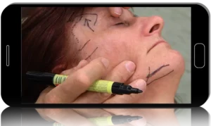 Innovative Facial Rejuvenation Techniques