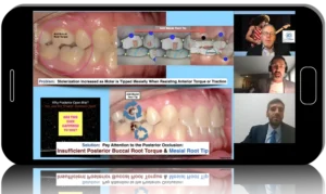Aligners from A to Z
