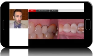 Modern Implant Success