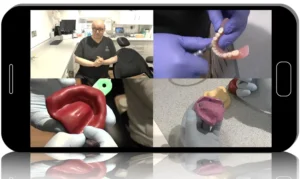 Removable Prosthodontics Essentials: Complete Dentures in the Digital Era