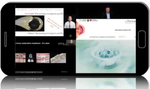 Periodontology: Complex Tissue Therapy