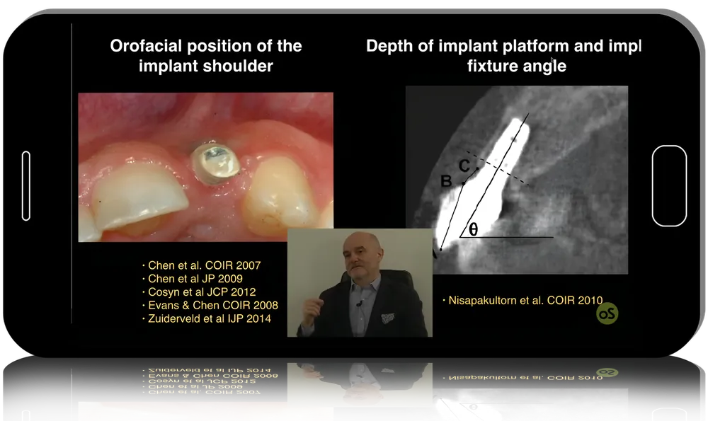 Advanced Techniques for Optimizing Gingival and Mucosal Health