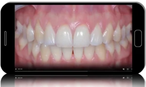 Soft Tissue Management in Periodontology and Implantology