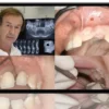 Advanced Bone Regeneration Protocols