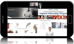 Surgery: Implantology and bone grafting