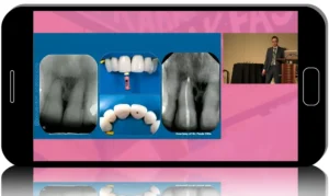 American Association of Endodontists (AAE). Annual Meeting 2022