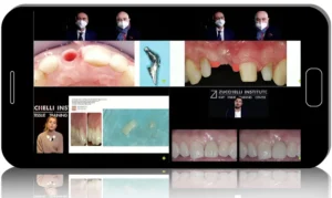 Teamwork in Periodontal & Peri-Implant Soft Tissues