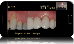 Masters of Soft Tissue